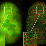 https://commons.wikimedia.org/wiki/File:GFP_Superresolution_Christoph_Cremer.JPG